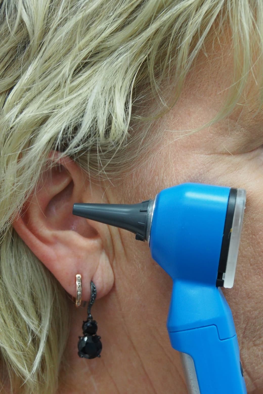 A clinician examining a patient's ear with an otoscope